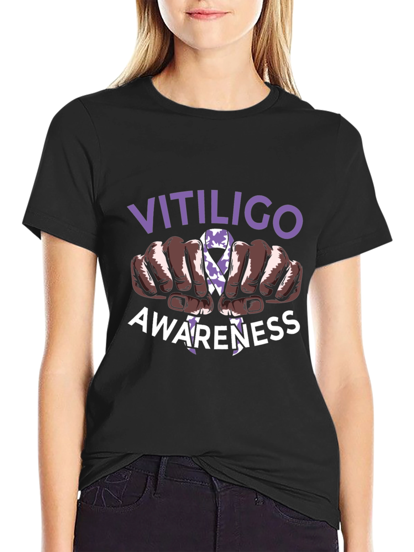 Vitiligo Awareness T-Shirt - Support Vitiligo Awareness