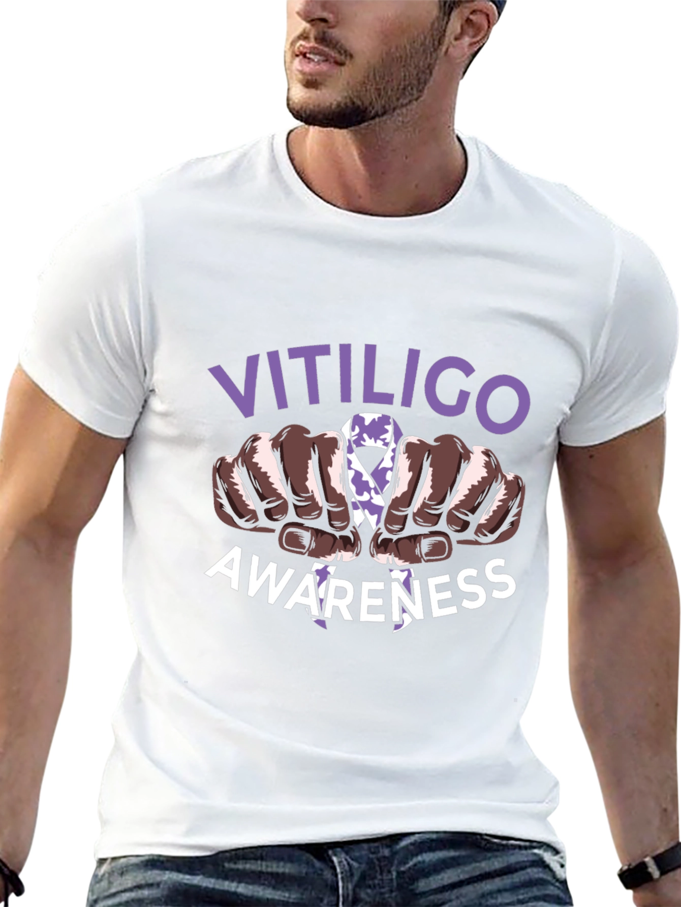 Vitiligo Awareness T-Shirt - Support Vitiligo Awareness