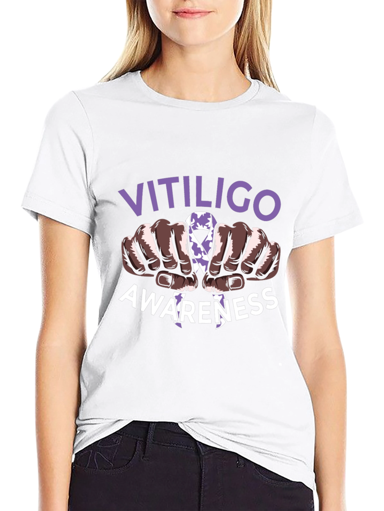 Vitiligo Awareness T-Shirt - Support Vitiligo Awareness