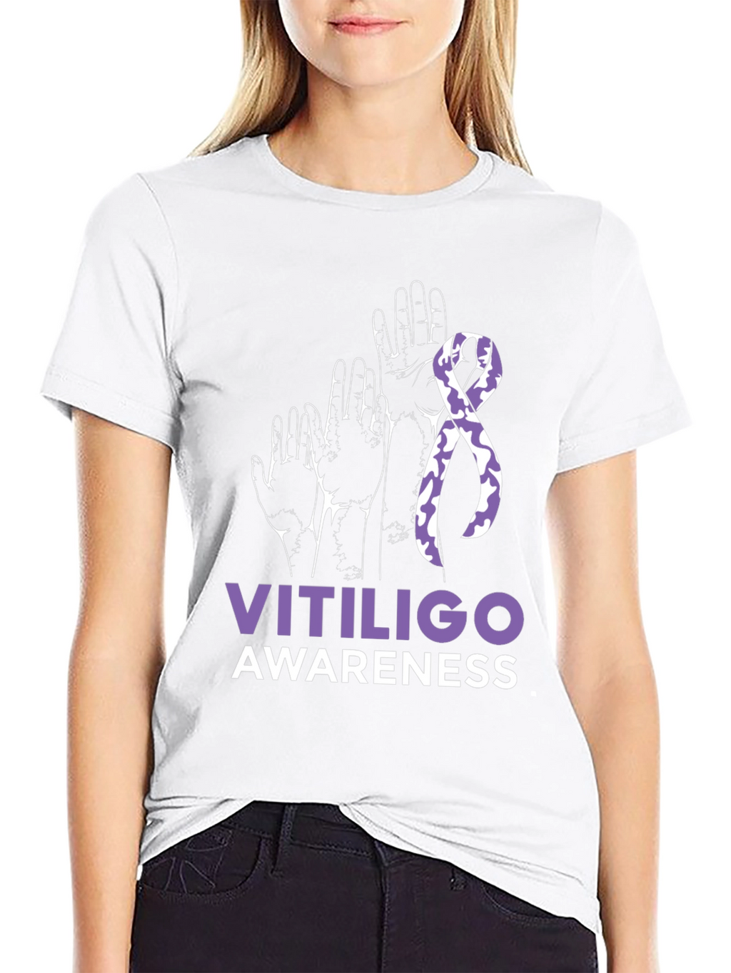 Vitiligo Awareness T-Shirt
