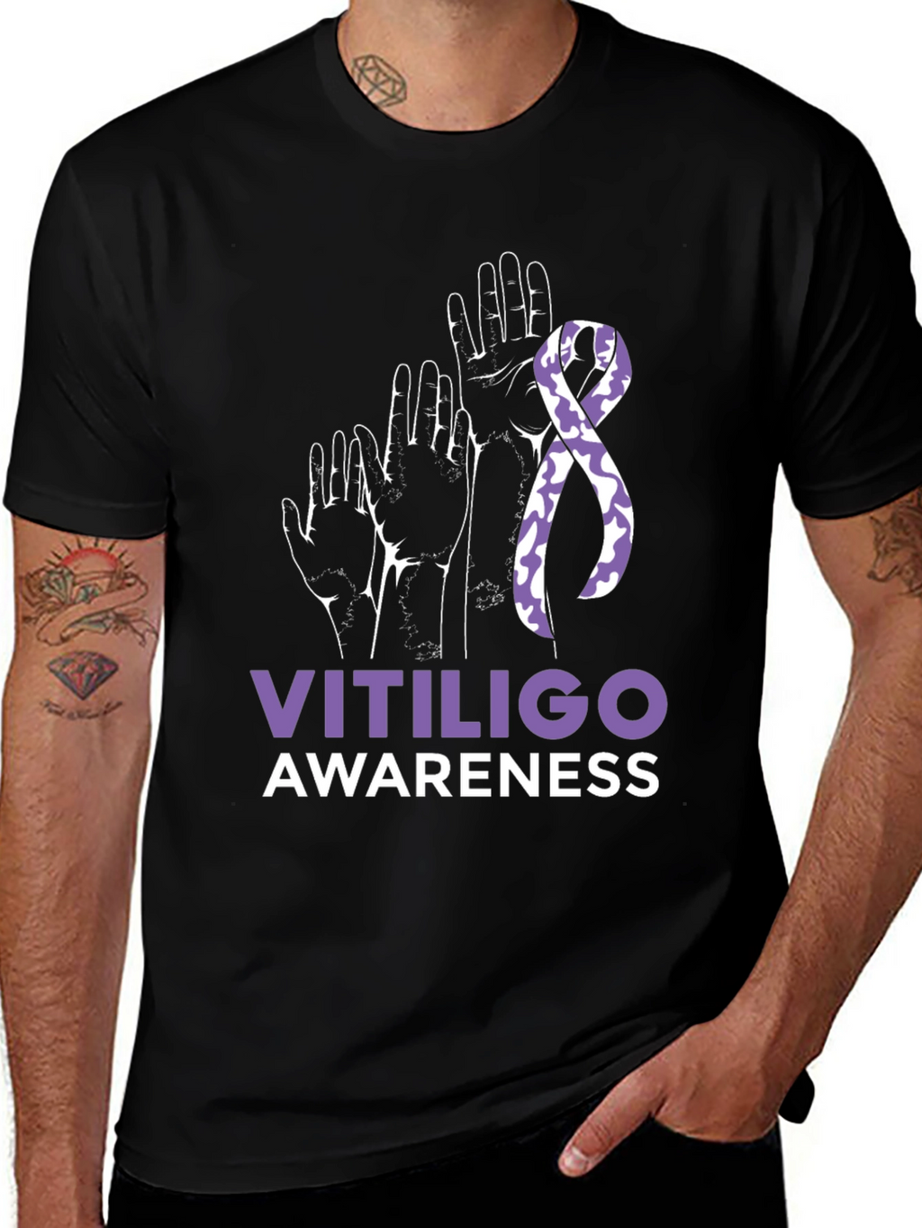Vitiligo Awareness T-Shirt