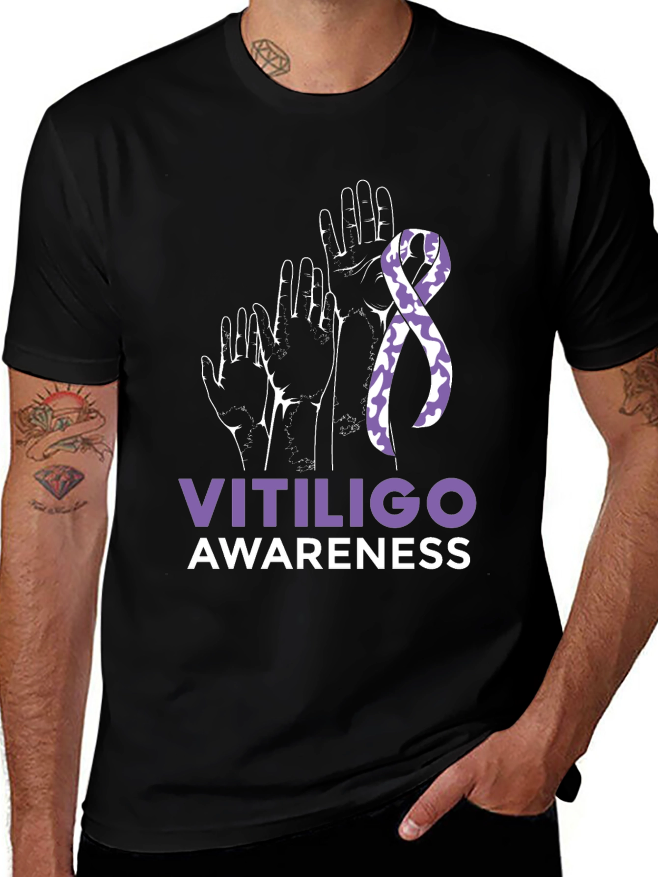 Vitiligo Awareness T-Shirt