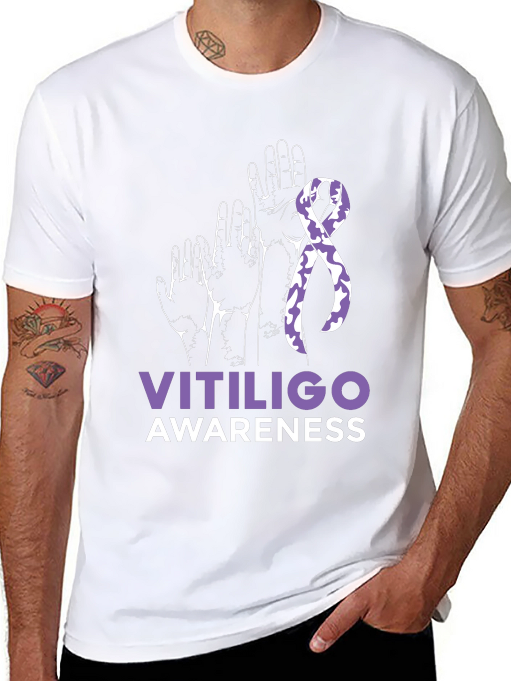 Vitiligo Awareness T-Shirt