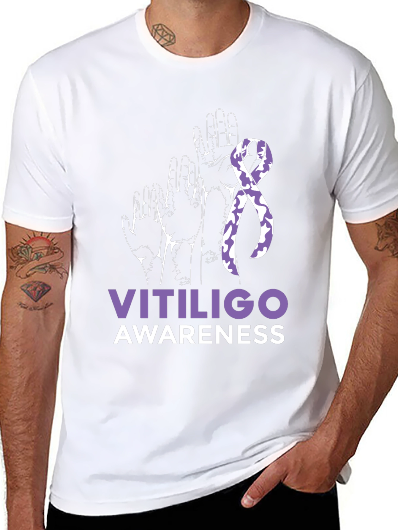 Vitiligo Awareness T-Shirt