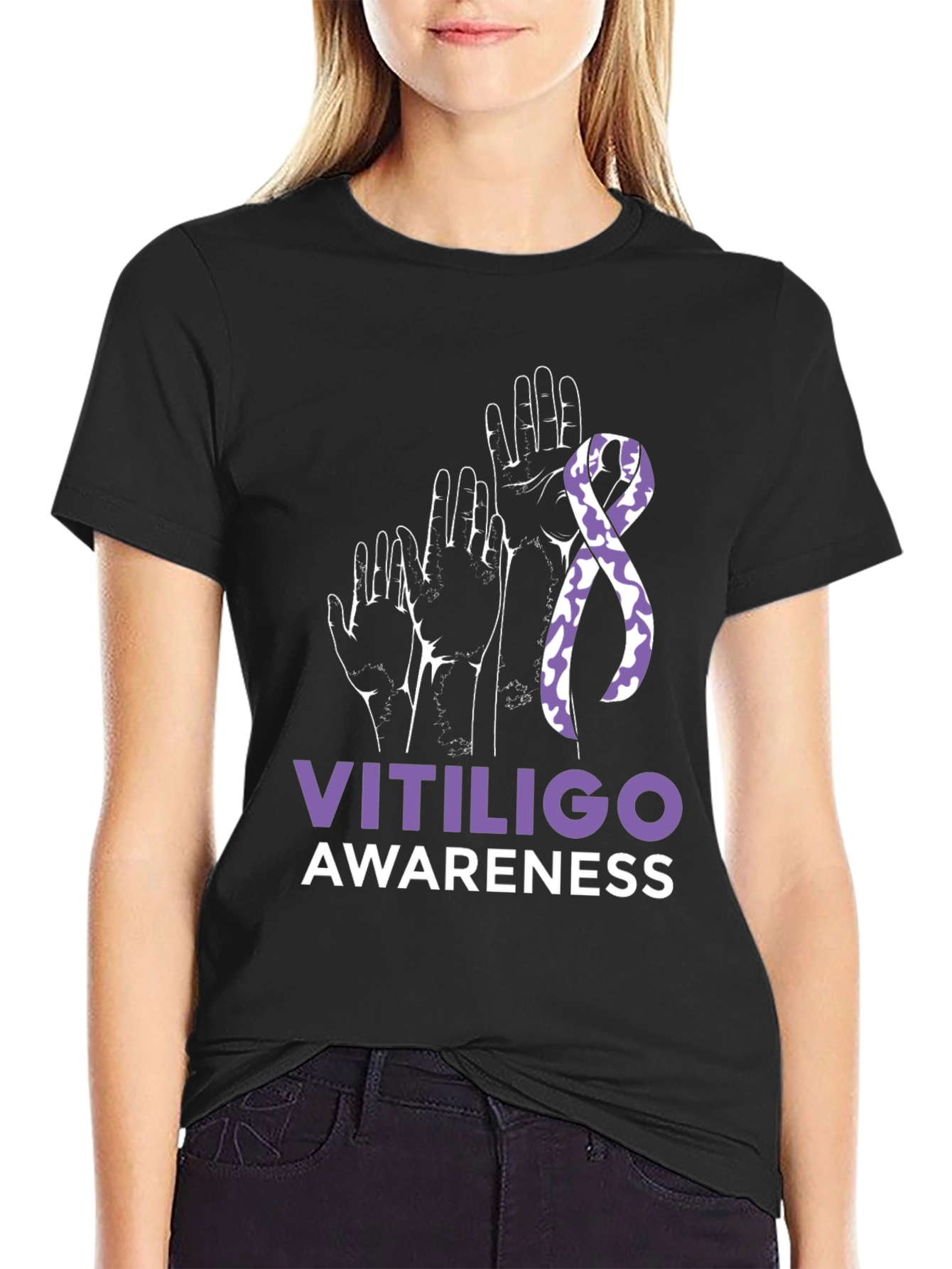 Vitiligo Awareness T-Shirt