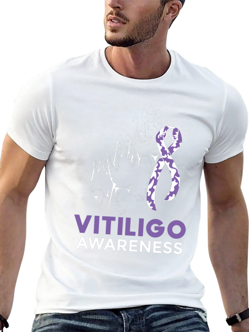 Vitiligo Awareness T-Shirt