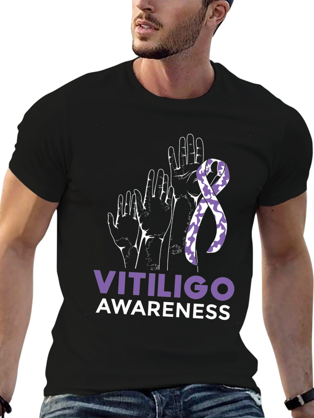 Vitiligo Awareness T-Shirt